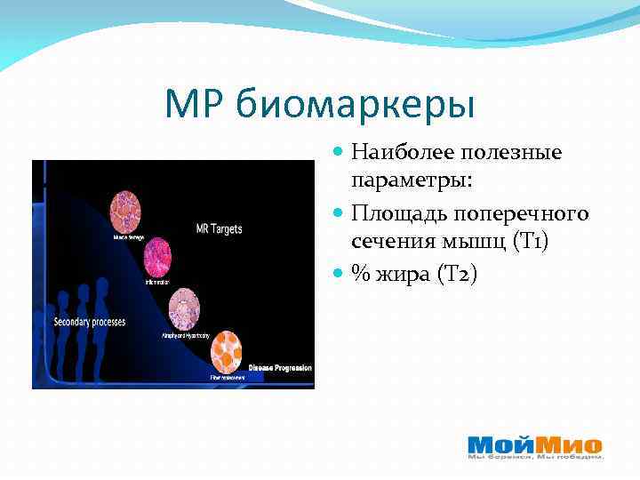 МР биомаркеры Наиболее полезные параметры: Площадь поперечного сечения мышц (Т 1) % жира (Т