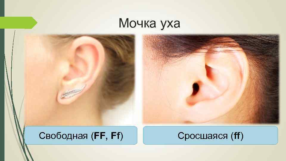 Форум ушей. Свободная и сросшаяся мочка уха. Свободные и сросшиеся мочки ушей.