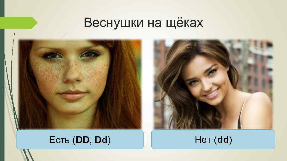 Веснушки на щёках Есть (DD, Dd) Нет (dd) 