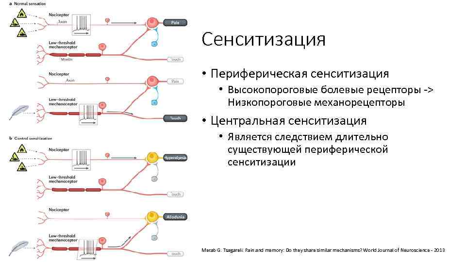 Сенситизация • Периферическая сенситизация • Высокопороговые болевые рецепторы -> Низкопороговые механорецепторы • Центральная сенситизация