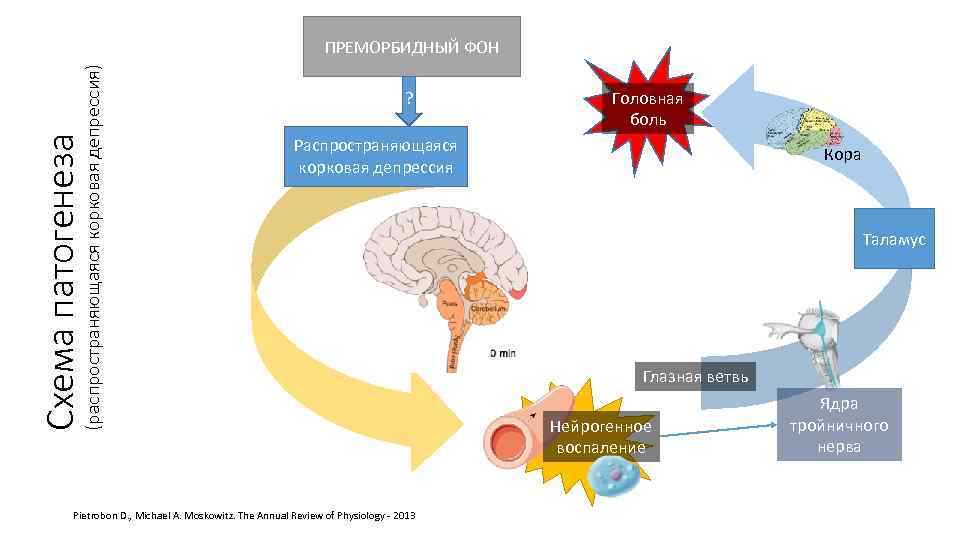 Схема патогенеза (распространяющаяся корковая депрессия) ПРЕМОРБИДНЫЙ ФОН ? Головная боль Распространяющаяся корковая депрессия Pietrobon