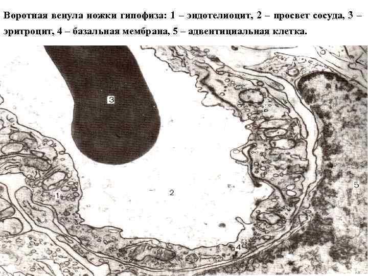 Воротная венула ножки гипофиза: 1 – эндотелиоцит, 2 – просвет сосуда, 3 – эритроцит,