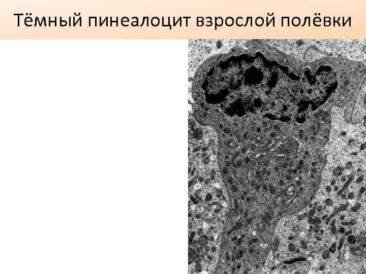 Тёмный пинеалоцит взрослой полёвки 