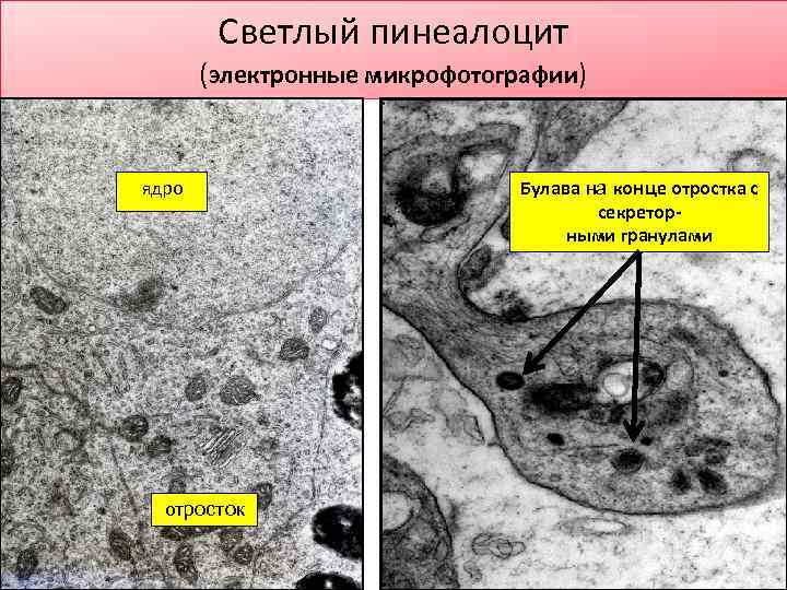 Светлый пинеалоцит (электронные микрофотографии) ядро отросток Булава на конце отростка с секреторными гранулами 