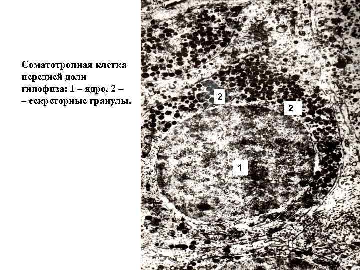 Соматотропная клетка передней доли гипофиза: 1 – ядро, 2 – – секреторные гранулы. 2