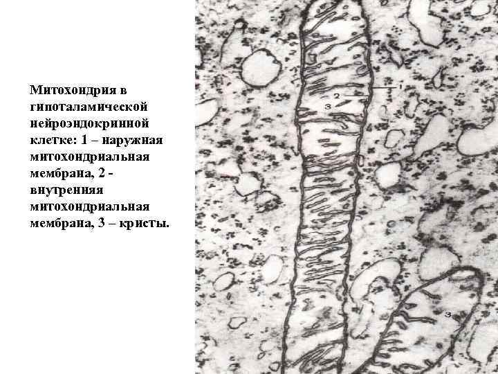 Митохондрия в гипоталамической нейроэндокринной клетке: 1 – наружная митохондриальная мембрана, 2 внутренняя митохондриальная мембрана,