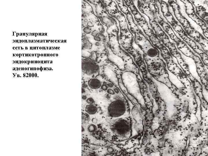 Гранулярная эндоплазматическая сеть в цитоплазме кортикотропного эндокриноцита аденогипофиза. Ув. 82000. 