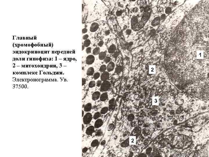 Главный (хромофобный) эндокриноцит передней доли гипофиза: 1 – ядро, 2 – митохондрии, 3 –