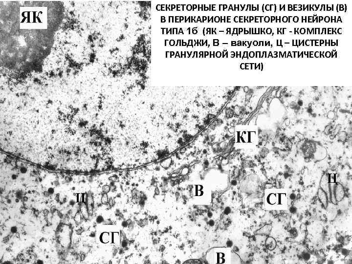 СЕКРЕТОРНЫЕ ГРАНУЛЫ (СГ) И ВЕЗИКУЛЫ (В) В ПЕРИКАРИОНЕ СЕКРЕТОРНОГО НЕЙРОНА ТИПА 1 б (ЯК