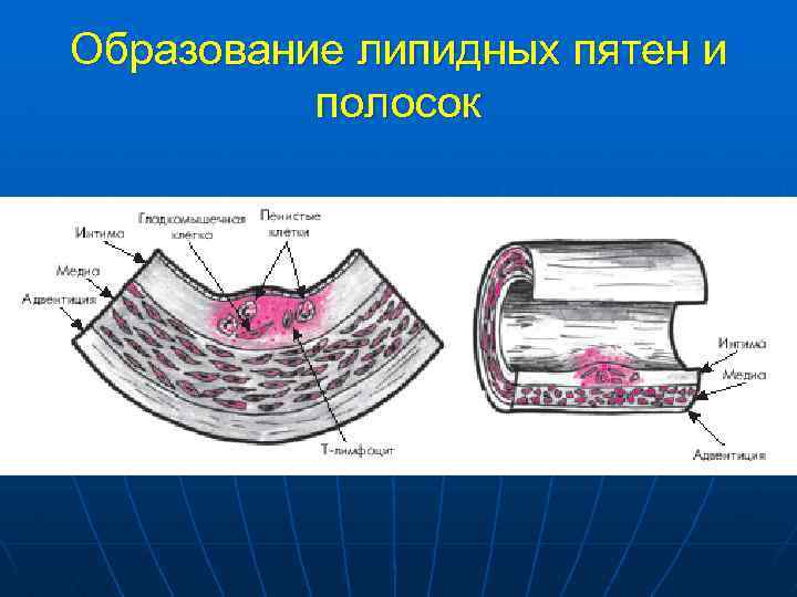 Образование липидных пятен и полосок 