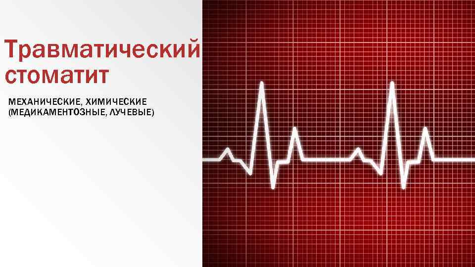 Травматический стоматит МЕХАНИЧЕСКИЕ, ХИМИЧЕСКИЕ (МЕДИКАМЕНТОЗНЫЕ, ЛУЧЕВЫЕ) 