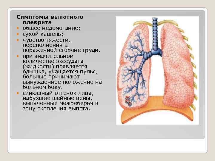 Плеврит легких без температуры