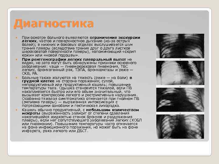 Диагностика При осмотре больного выявляются ограничение экскурсии легких, частое и поверхностное дыхание (из за