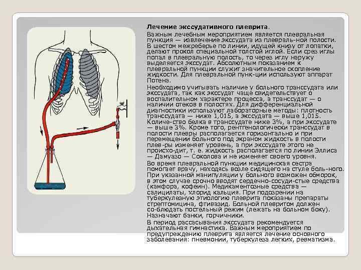 Лечение экссудативного плеврита. Важным лечебным мероприятием является плевральная пункция — извлечение экссудата из плевраль
