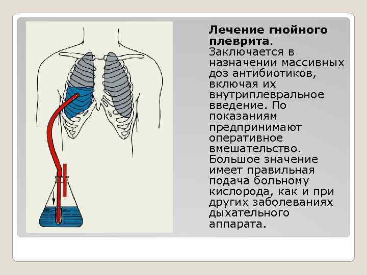 Лечение гнойного плеврита. Заключается в назначении массивных доз антибиотиков, включая их внутриплевральное введение. По