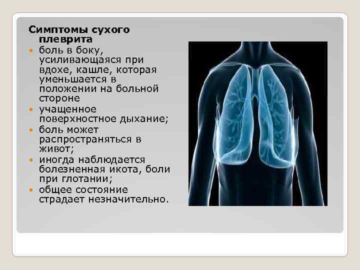 Симптомы сухого плеврита боль в боку, усиливающаяся при вдохе, кашле, которая уменьшается в положении