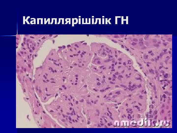 Капиллярішілік ГН 