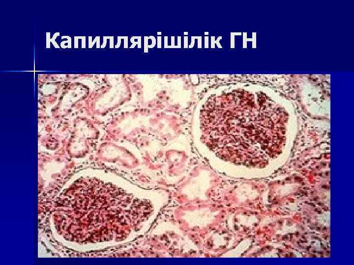 Капиллярішілік ГН 