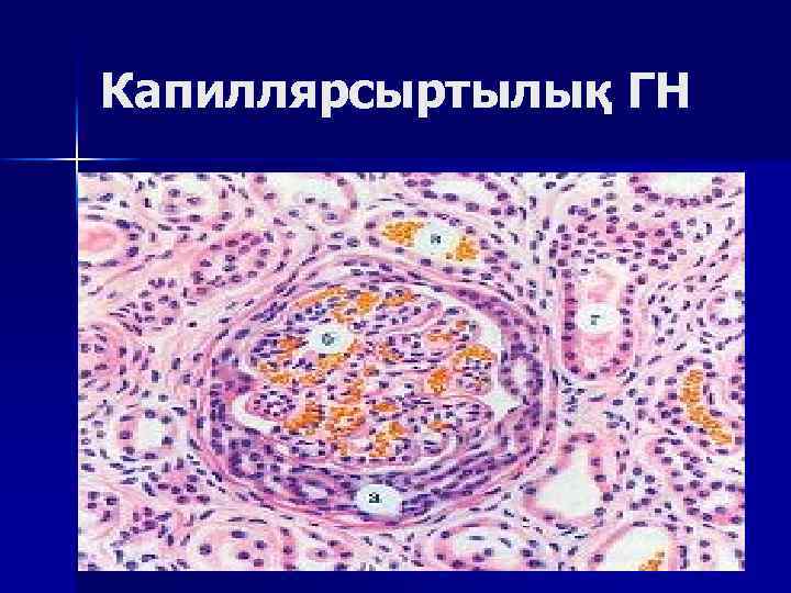 Капиллярсыртылық ГН 