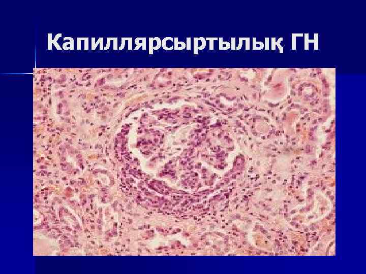 Капиллярсыртылық ГН 