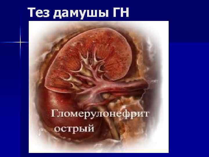 Тез дамушы ГН 