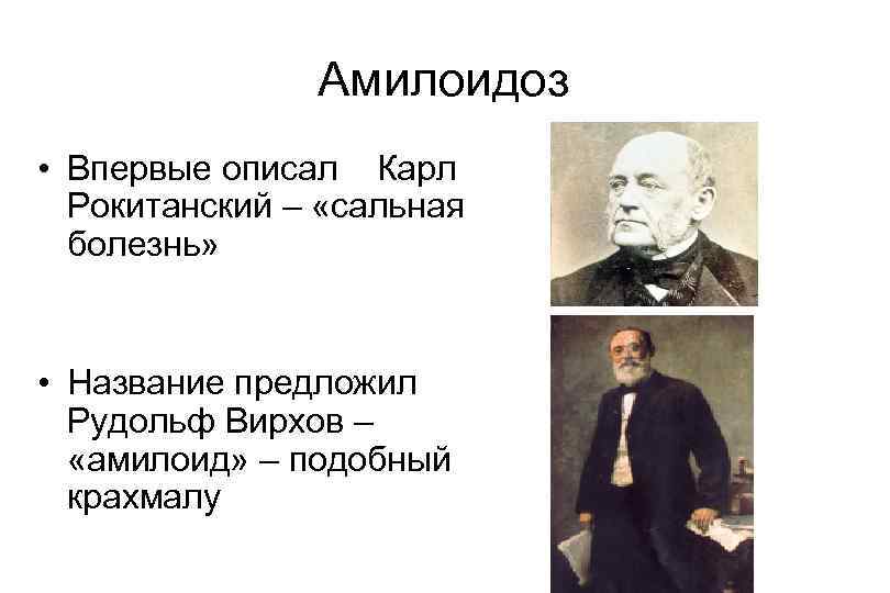 Амилоидоз • Впервые описал Карл Рокитанский – «сальная болезнь» • Название предложил Рудольф Вирхов
