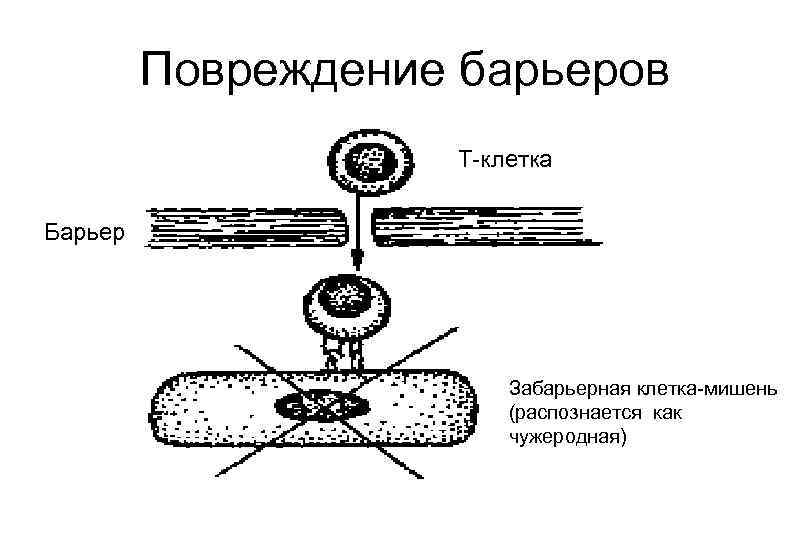 Повреждение барьеров Т-клетка Барьер Забарьерная клетка-мишень (распознается как чужеродная) 
