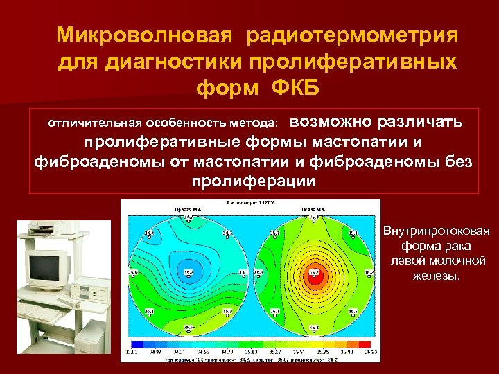 Микроволновая радиотермометрия для диагностики пролиферативных форм ФКБ возможно различать пролиферативные формы мастопатии и фиброаденомы