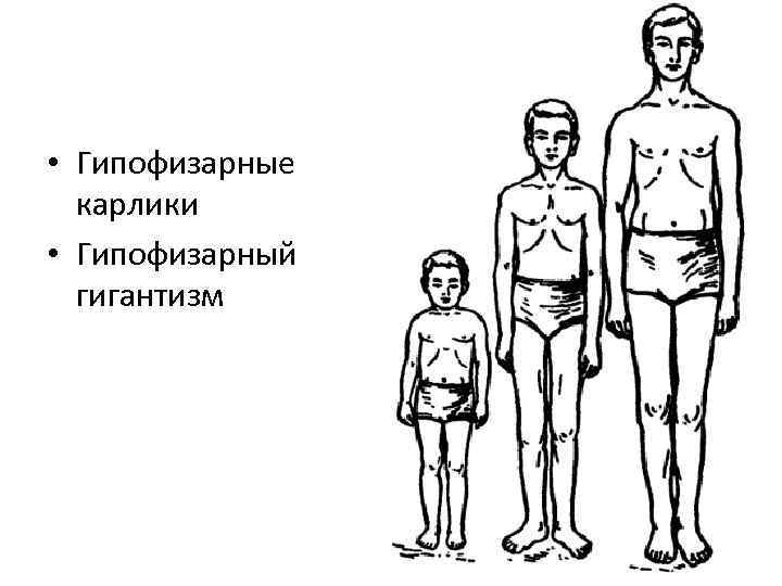 Гипофизарный гигантизм презентация