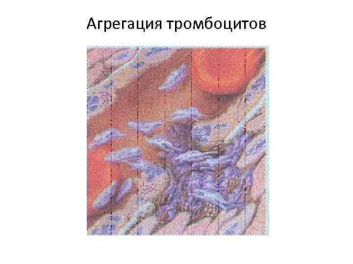 Агрегация тромбоцитов 