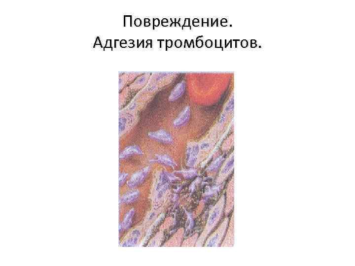 Повреждение. Адгезия тромбоцитов. 