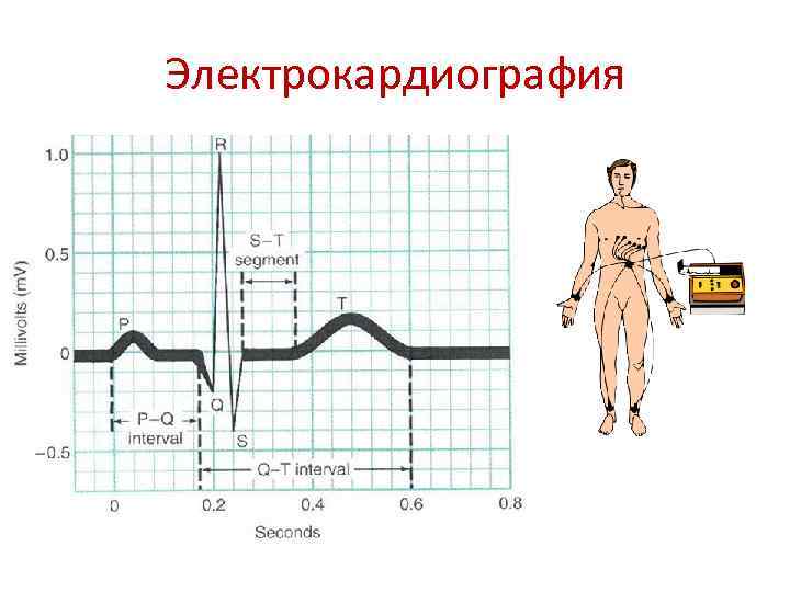 Электрокардиография 