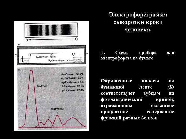 Электрофореграмма сыворотки крови человека. А. Схема прибора электрофореза на бумаге для Окрашенные полосы на