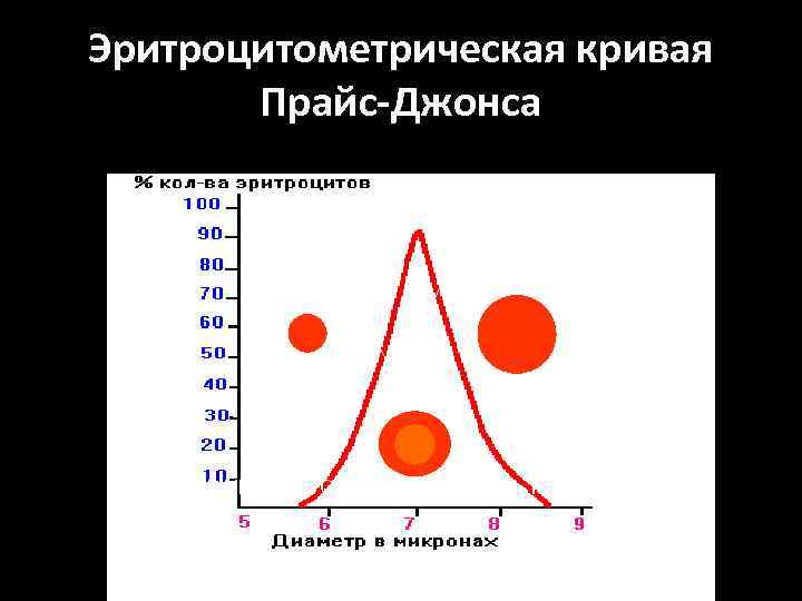 Эритроцитометрическая кривая Прайс-Джонса МИКРОЦИТОЗ, НОРМОЦИТОЗ, МАКРОЦИТОЗ 