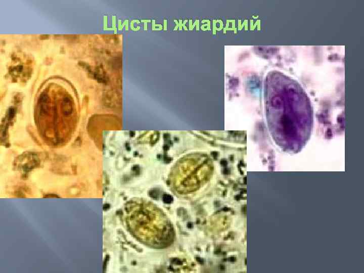 Цисты жиардий 