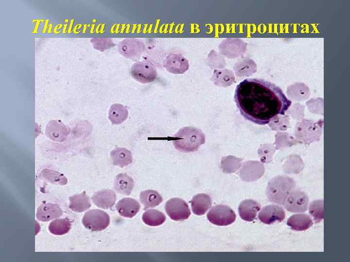 Theileria annulata в эритроцитах 