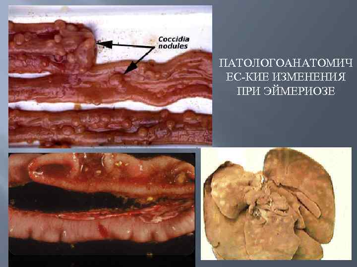 ПАТОЛОГОАНАТОМИЧ ЕС КИЕ ИЗМЕНЕНИЯ ПРИ ЭЙМЕРИОЗЕ 