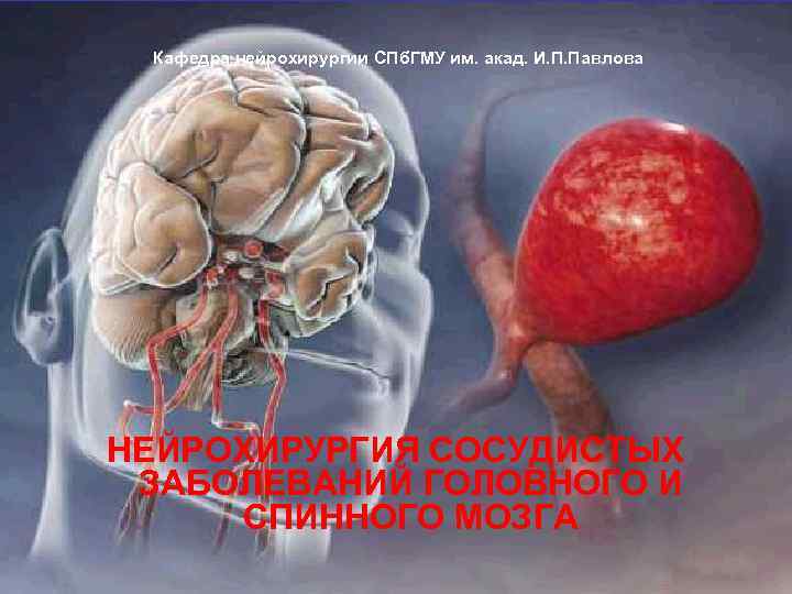  Кафедра нейрохирургии СПб. ГМУ им. акад. И. П. Павлова НЕЙРОХИРУРГИЯ СОСУДИСТЫХ ЗАБОЛЕВАНИЙ ГОЛОВНОГО