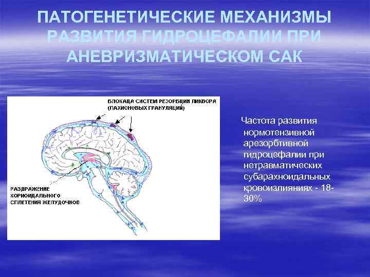 ПАТОГЕНЕТИЧЕСКИЕ МЕХАНИЗМЫ РАЗВИТИЯ ГИДРОЦЕФАЛИИ ПРИ АНЕВРИЗМАТИЧЕСКОМ САК Частота развития нормотензивной арезорбтивной гидроцефалии при нетравматических