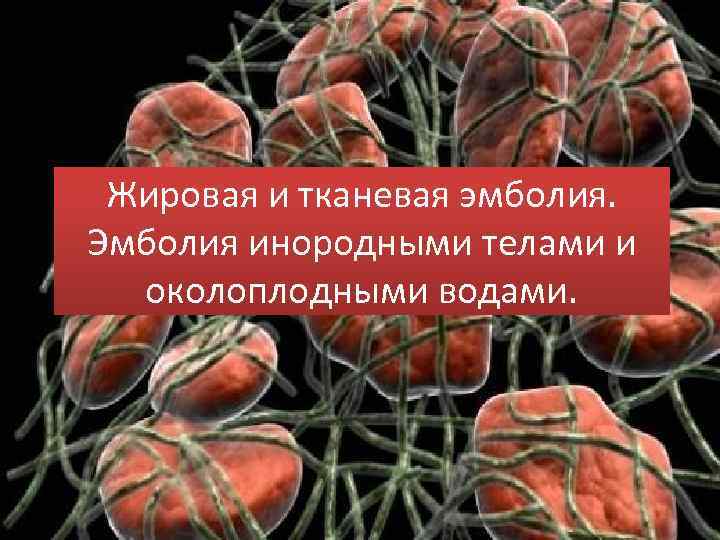 Жировая и тканевая эмболия. Эмболия инородными телами и околоплодными водами. 