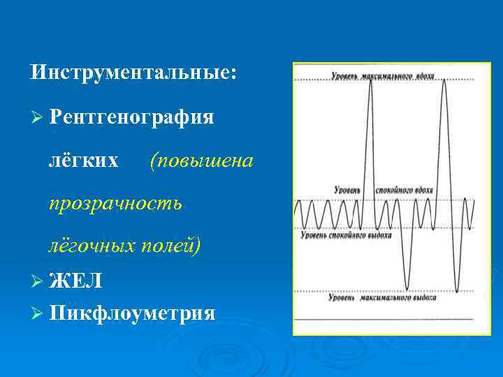 Инструментальные: Ø Рентгенография лёгких (повышена прозрачность лёгочных полей) Ø ЖЕЛ Ø Пикфлоуметрия 