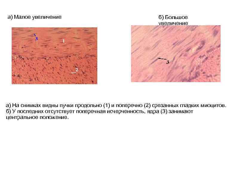 а) Малое увеличение б) Большое увеличение а) На снимках видны пучки продольно (1) и