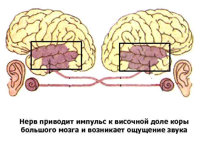  Нерв приводит импульс к височной доле коры большого мозга и возникает ощущение звука