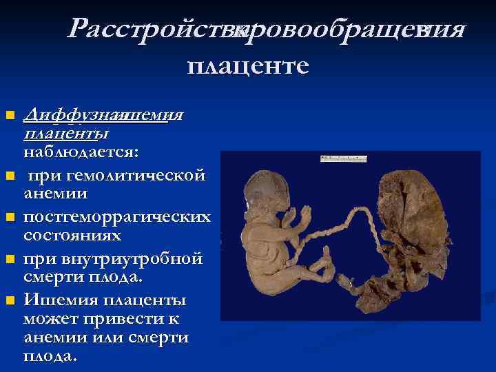 Расстройства кровообращения в плаценте n n n Диффузная ишемия плаценты наблюдается: при гемолитической анемии