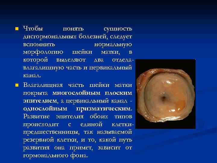n n Чтобы понять сущность дисгормональных болезней, следует вспомнить нормальную морфологию шейки матки, в
