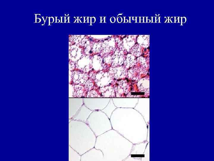 Бурый жир и обычный жир 