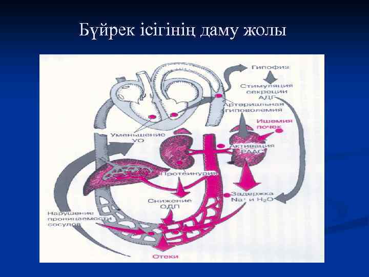 Бүйрек ісігінің даму жолы 
