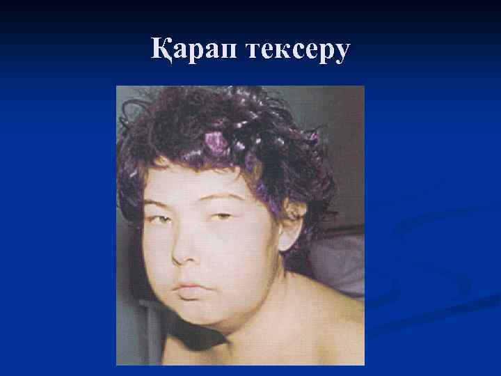 Қарап тексеру 