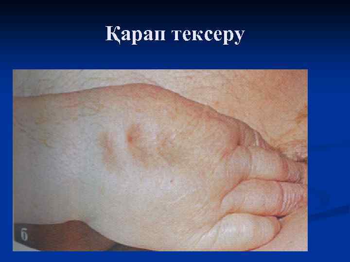 Қарап тексеру 