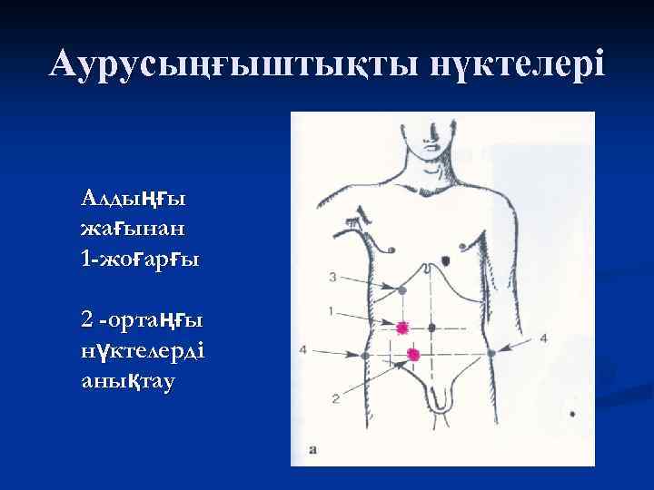 Аурусыңғыштықты нүктелері Алдыңғы жағынан 1 -жоғарғы 2 -ортаңғы нүктелерді анықтау 